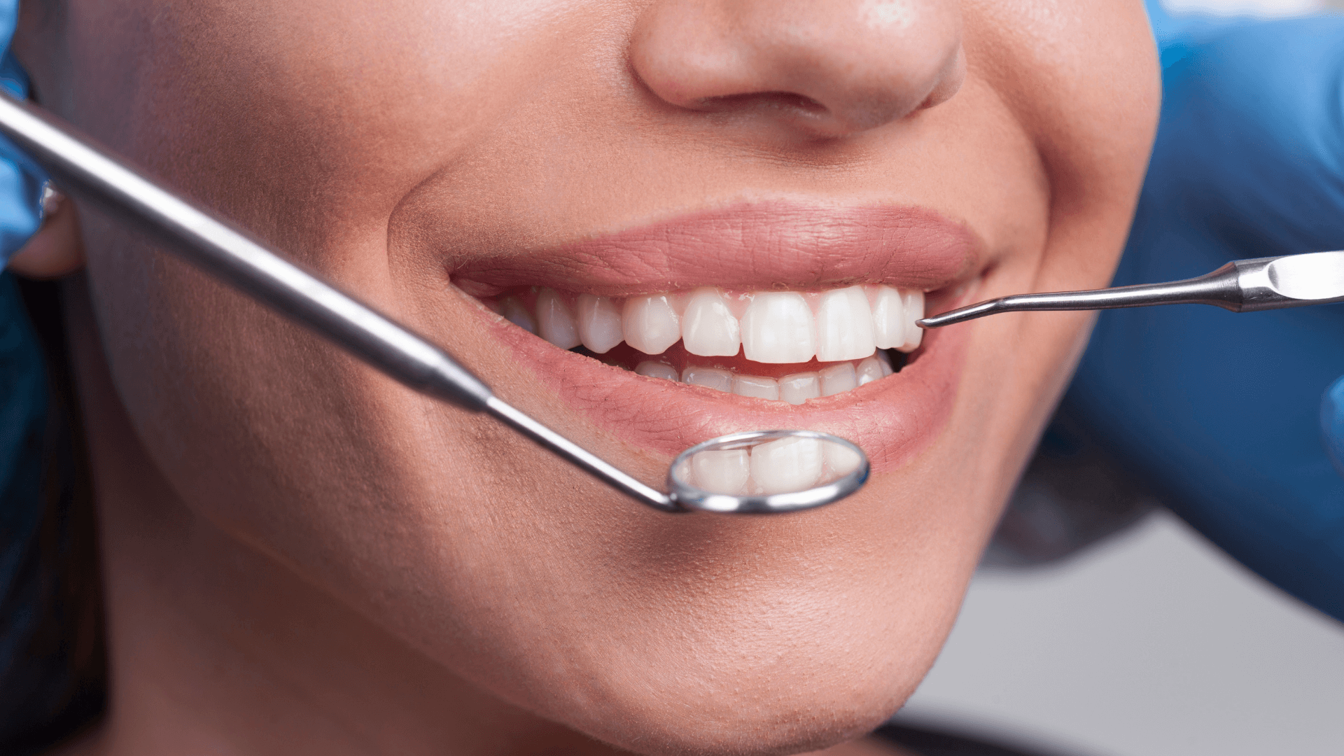 Top Dental Tourism Destinations in Turkey: Best Cities for a Healthy Smile